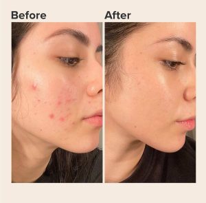 سرم نیاسینامید اوردینری
